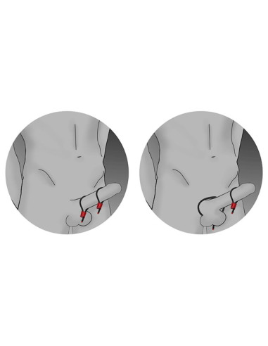 ELECTRASTIM - PRESTIGE ELECTRA LOOPS ADJUSTABLE COCK RINGS BLACK