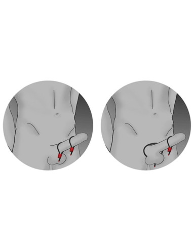 ELECTRASTIM - PRESTIGE ELECTRA LOOPS reguliuojami varpos žiedai, raudoni