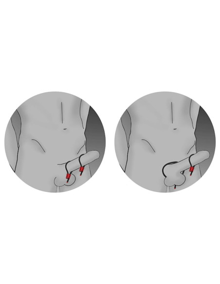 ELECTRASTIM - PRESTIGE ELECTRA LOOPS reguliuojami penio žiedai, juodi